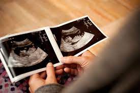 Your-baby-8-week-fetus