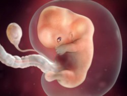 9-week-fetus