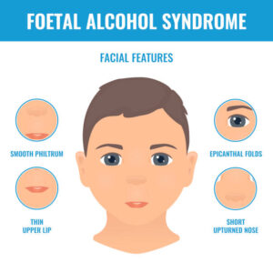 Fetal Alcohol Spectrum Disorders 
