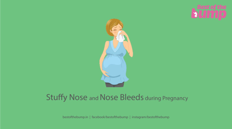 nose bleeds in pregnancy