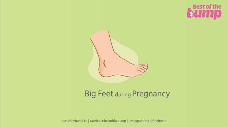 Big Feet during Pregnancy
