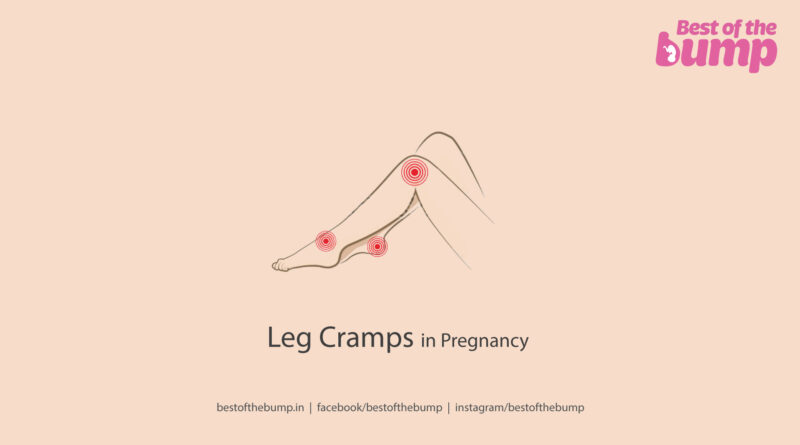 Leg Cramps in Pregnancy