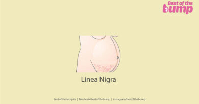 Linea Nigra