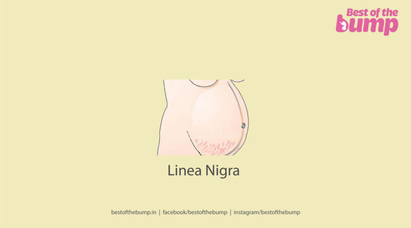 Linea Nigra