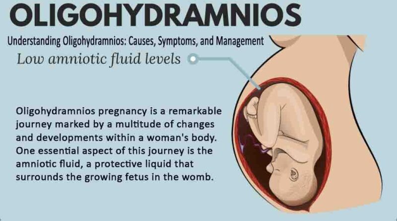 Understanding Oligohydramnios: Causes, Symptoms, and Management